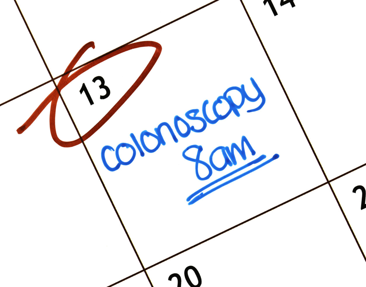 colonoscopy